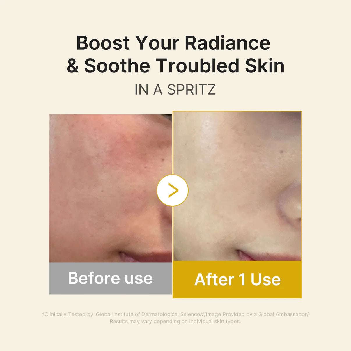 Kojic Acid Turmeric Vitamin Gold Jelly Mist Serum - (Pre Venta 25 días )