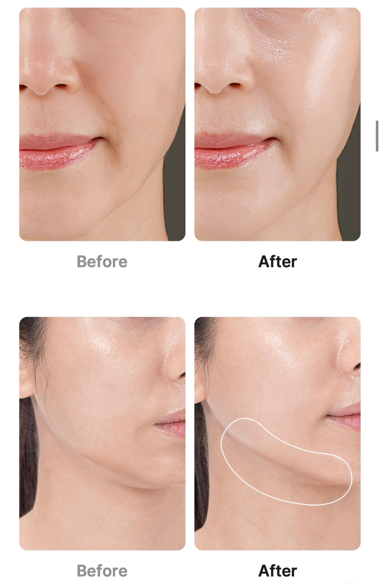 Medicube Age R Booster Pro