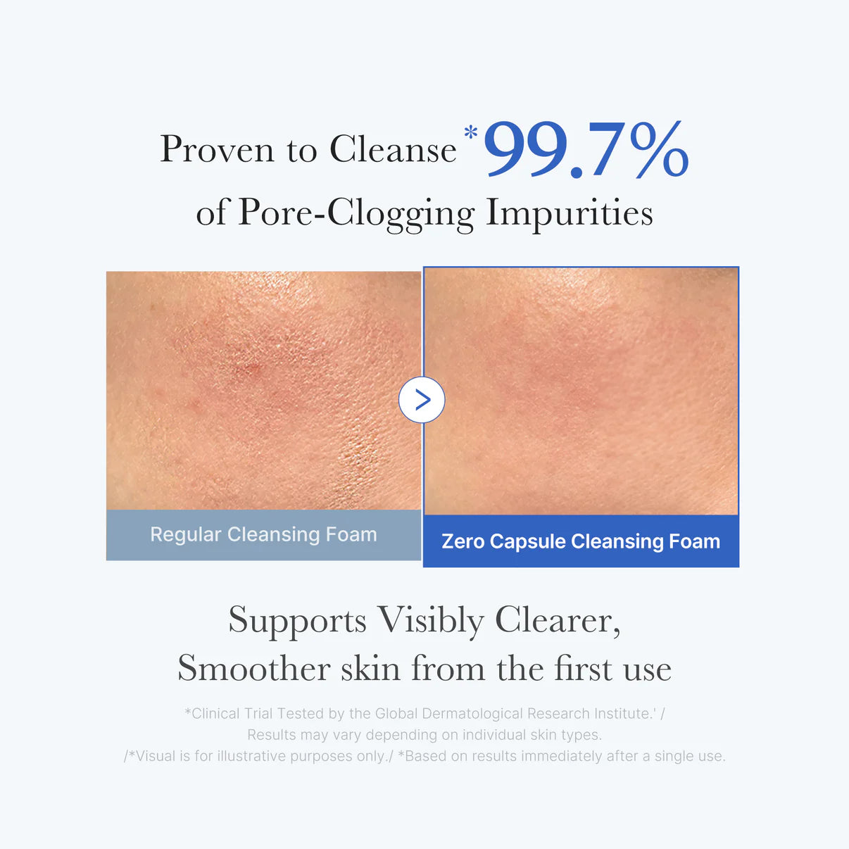 Zero Pore Sa Clear Capsule Cleanser Foam
