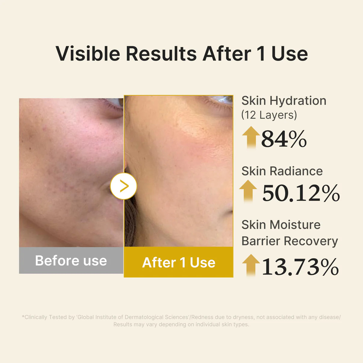 Kojic Acid Turmeric Vitamin Gold Jelly Mist Serum - (Pre Venta 25 días )