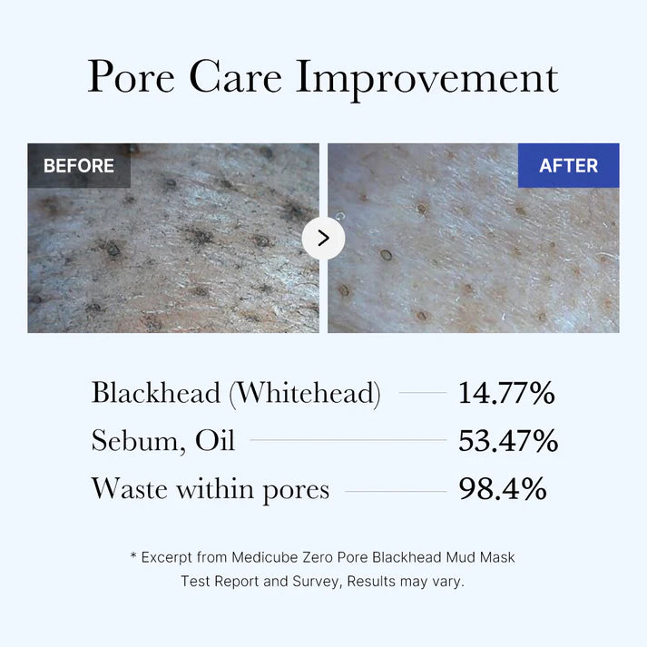 Medicube Zero Pore Blackhead Mud Mask – Mascarilla Facial Purificante de Poros