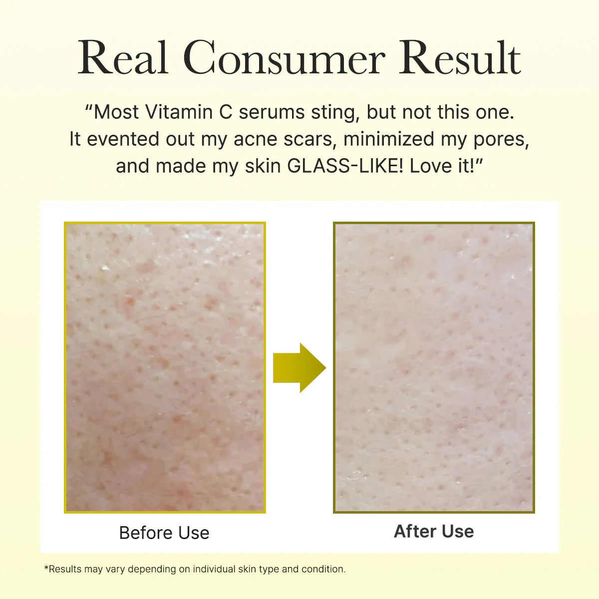 Arencia Vitamin C Booster Shot, Pure Vitamin C + Glutathione For Bright 30 ml